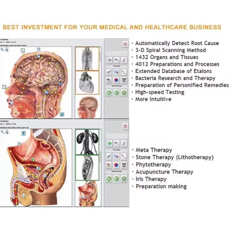 Metatron Hunter 4025 NLS Biore – Holistic Health & Wellness recenzja i cena